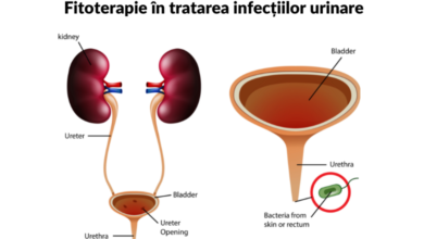 fitoterapie infectii urinare